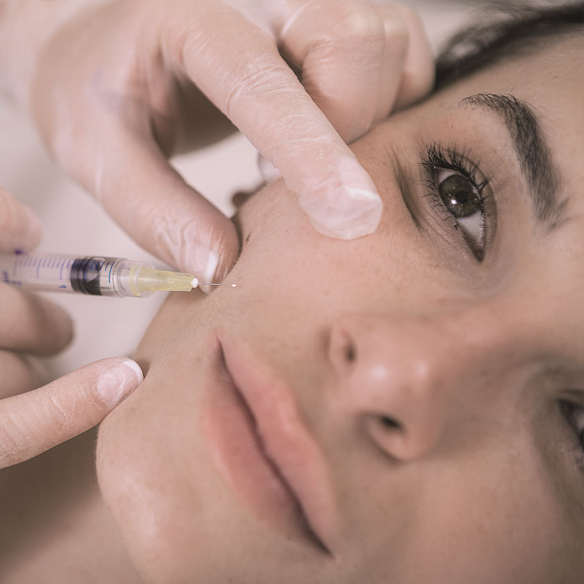 Hyaluron Hautbehandlung Faltenbehandlung, Anti-Aging - AVORYA